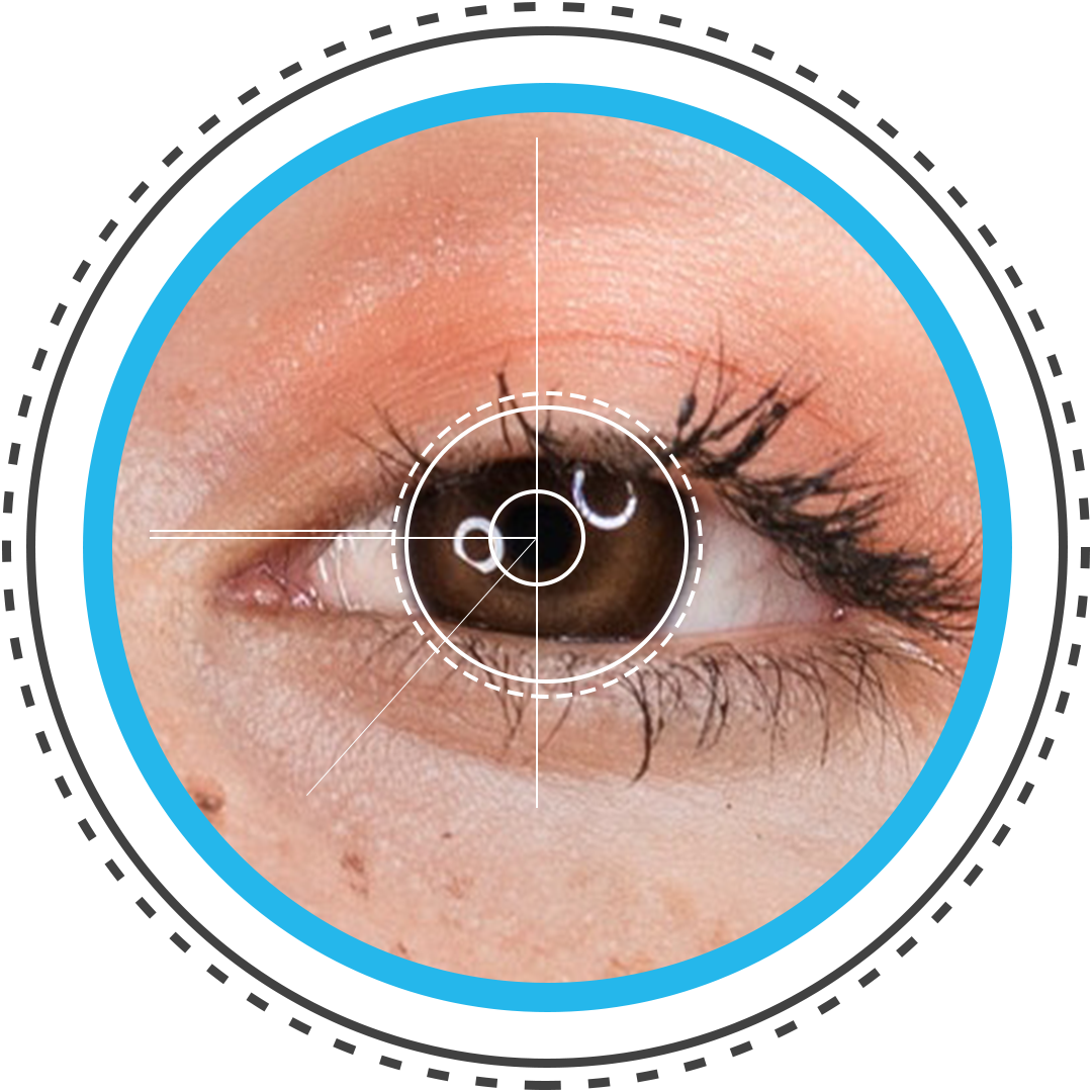 best-lasik-eye-surgery-in-dubai-lasik-eye-surgeons